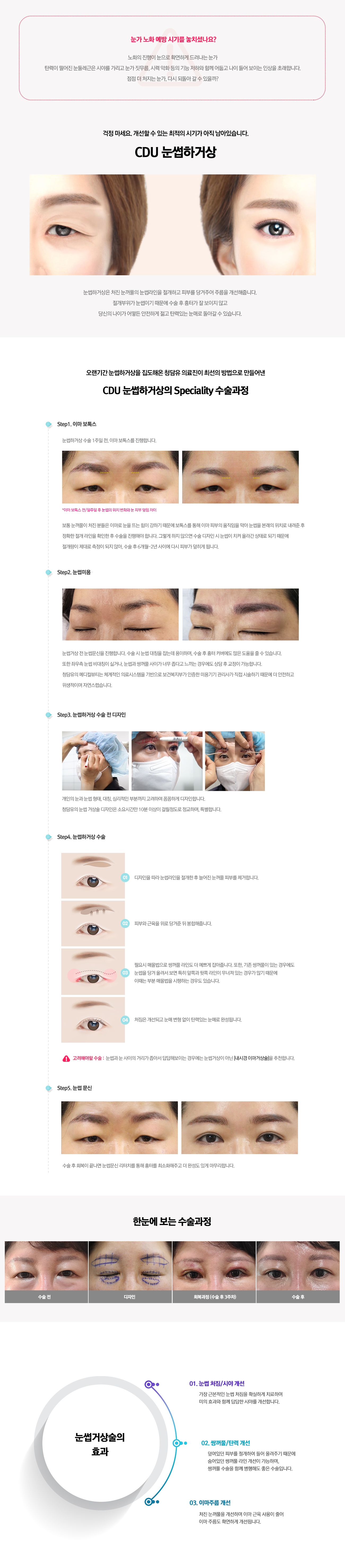 눈썹하거상