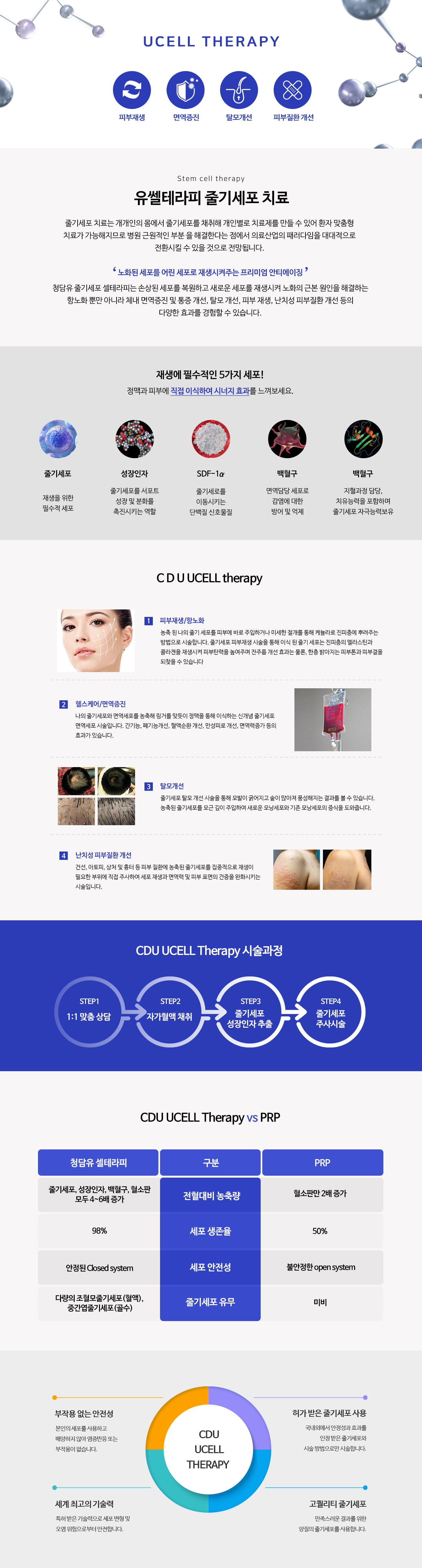 줄기세포치