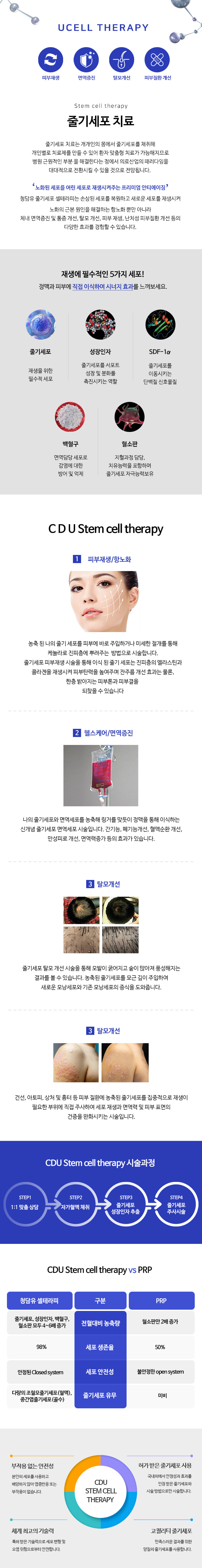 줄기세포치료